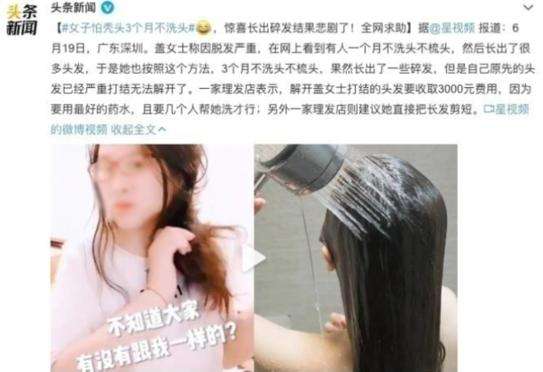 应对脱发不焦虑 治脱发的正确操作看这里