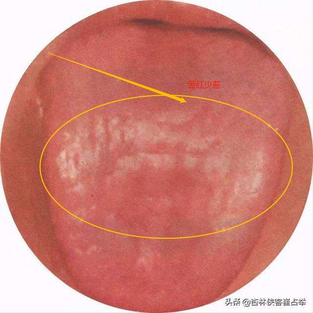 肝血虚？肝阴虚？肝出了问题要怎么调理？分享两招帮你轻松缓解