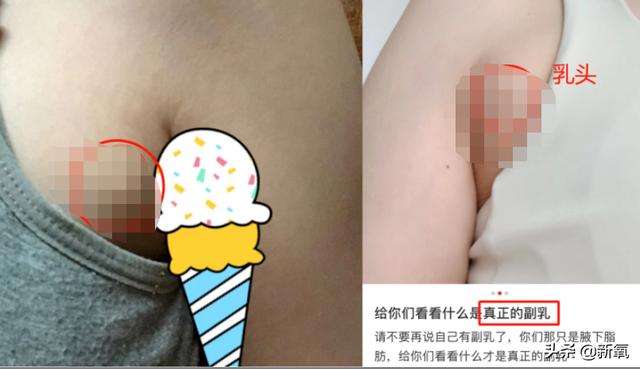 直角肩代言人因为副乳翻车？！明明胸都要瘦没了呀…