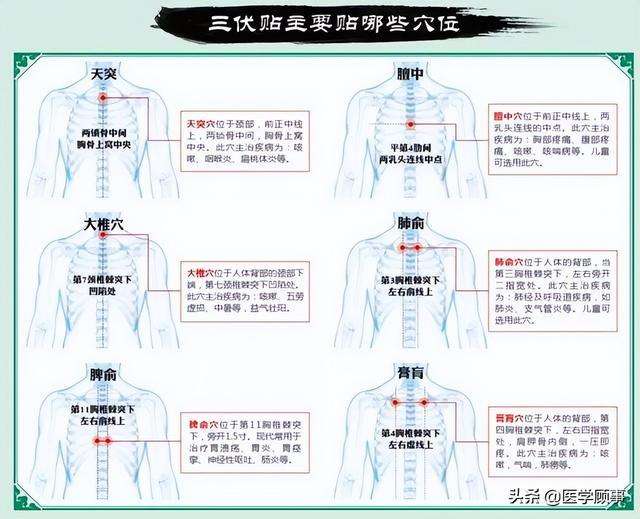 三伏贴常见病配方大全