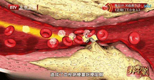 “软化血管”骗了国人30年，而真相只有一个