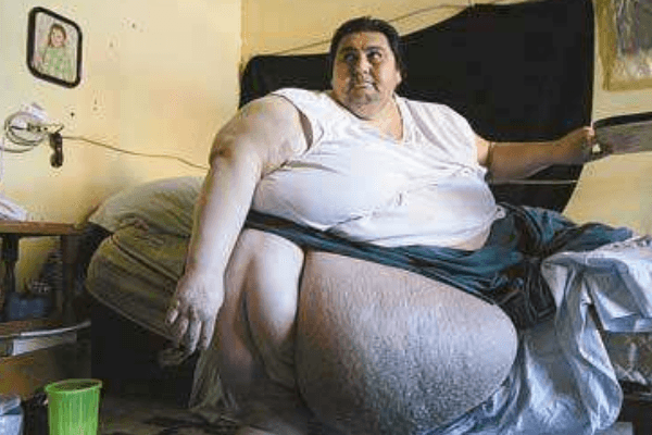 世界上最胖男子